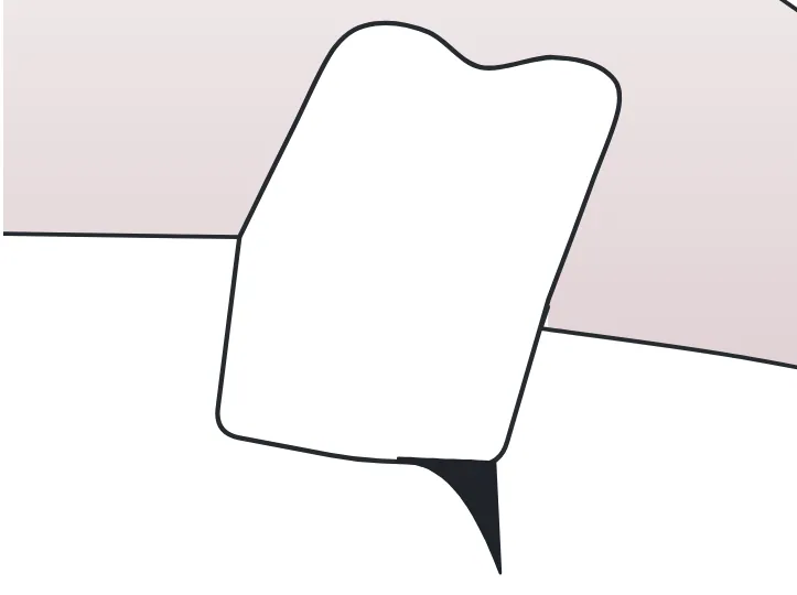 Pointe d’émail dessinée sur une dent du schéma