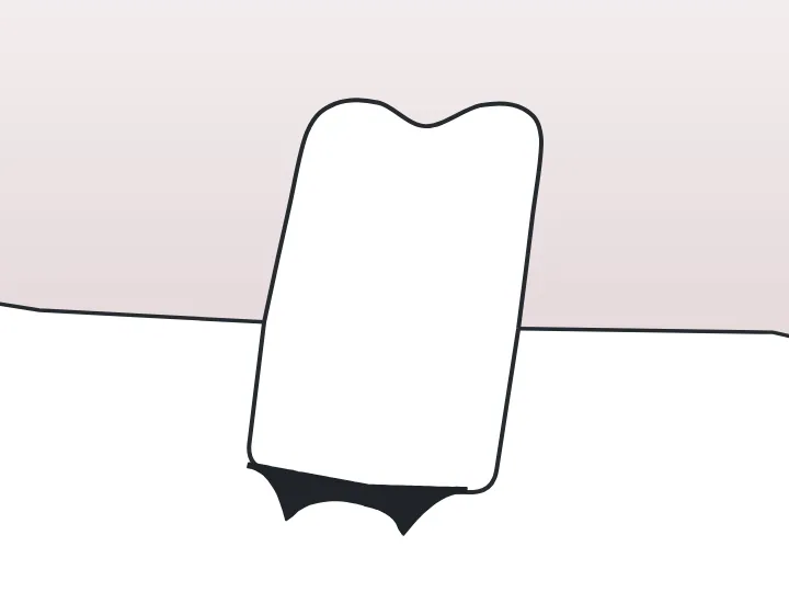 Surdents dessinée sur une dent du schéma